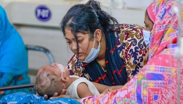 Measles death toll in Sylhet region reaches 110; 286 patients under treatment