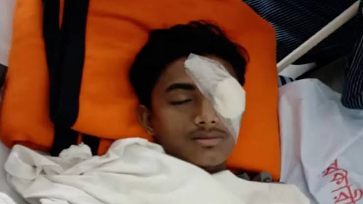 হবিগঞ্জে হামলায় দৃষ্টিশক্তি হারিয়ে ছাত্র আলিফ, কঠিন পারিবারিক পটভূমিতে পড়াশোনা করতেন